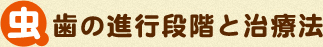 虫歯の進行段階と治療法